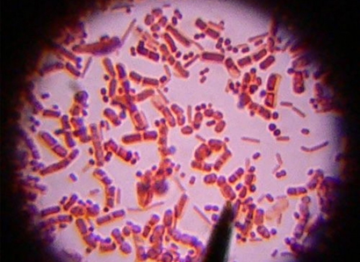 bacteria-ccflcr-kaibara871