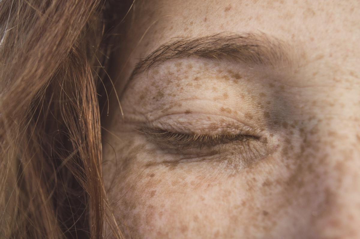 Freckled person closes eyes