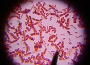 Microscopic view of rod-shaped bacteria cells stained purple and orange