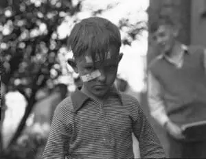Child wearing striped shirt with bandages on face and eyes
