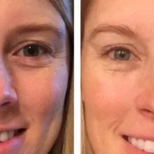 Drinking Water to Look Younger