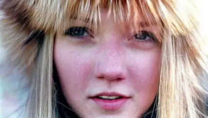 home remedies for dry skin