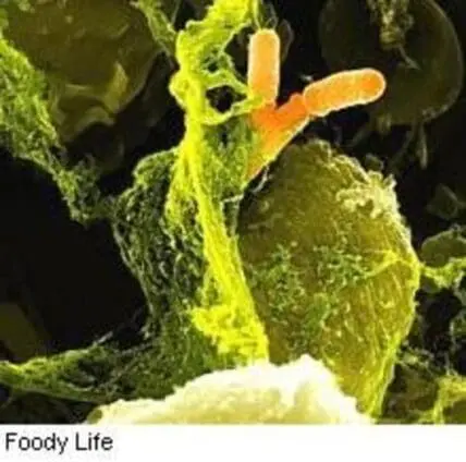Colorized microscopic view of Listeria monocytogenes bacteria