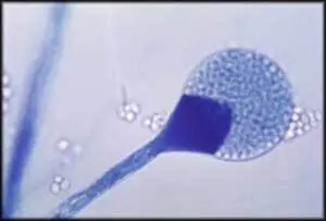 Microscopic view of a mold spore with branching filaments