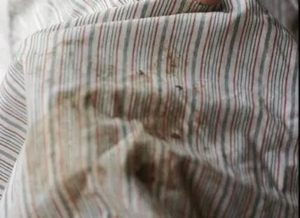 Stained striped fabric showing brown marks on white and red striped material