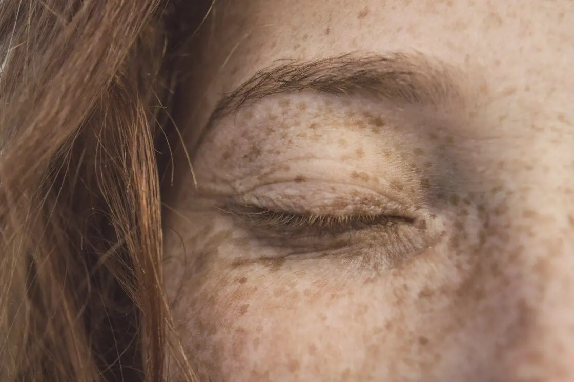 Freckled person closes eyes showing benefits of vegan collagen supplements