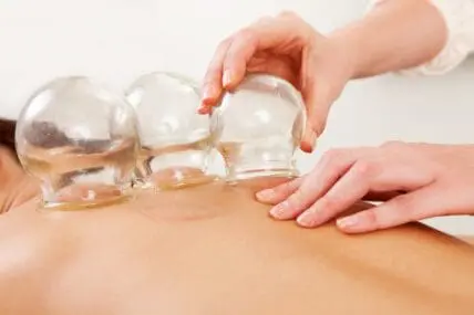 What is Cupping and Why is Michael Phelps a Fan?