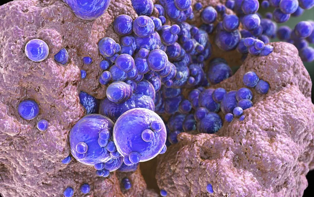 Medieval Elixir Miraculously Kills Deadly MRSA Infection