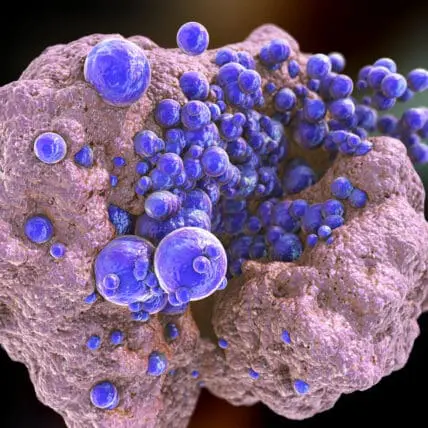 Medieval Elixir Miraculously Kills Deadly MRSA Infection
