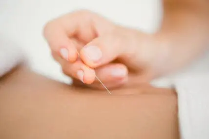 Get to the Point: Treating Infertility with Acupuncture