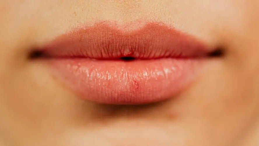 Best Natural Lip Sunscreens for Summer 2016
