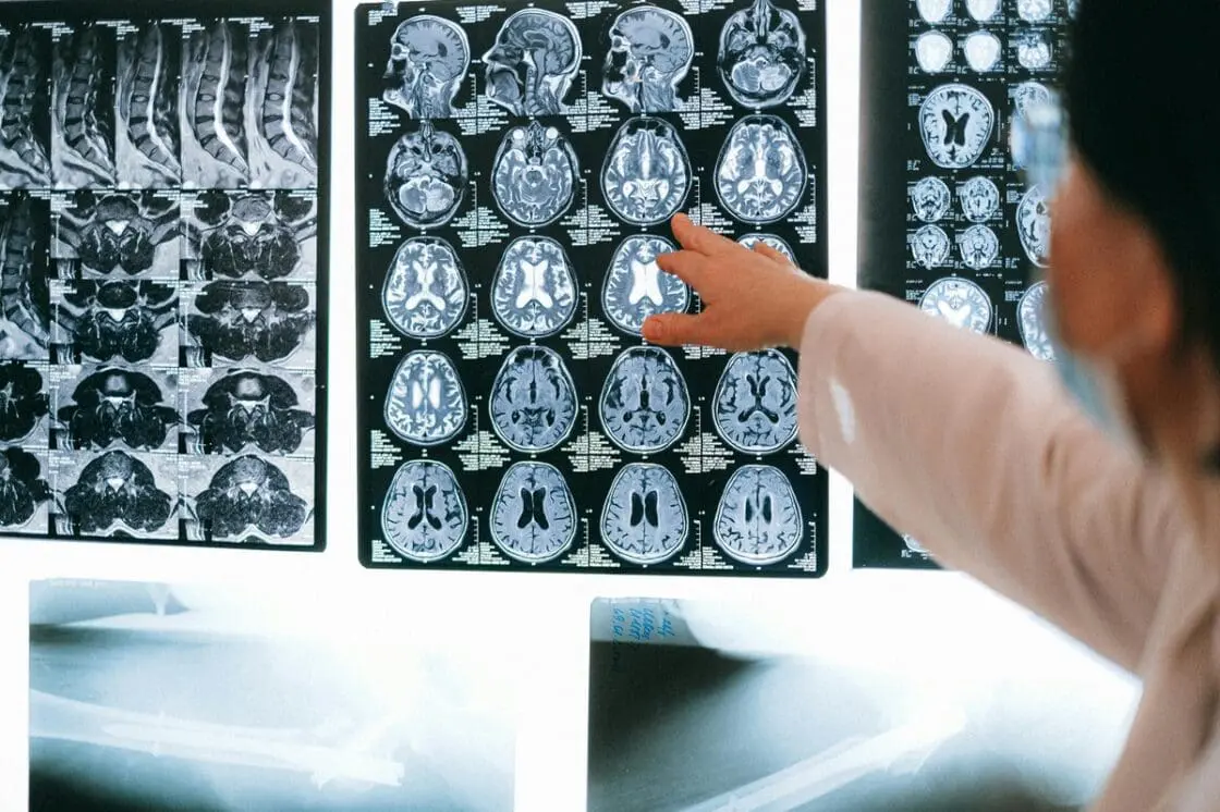 Image of a doctor in a white coat pointing at various sheets of MRI results, lit up and highlighting brain scans.
