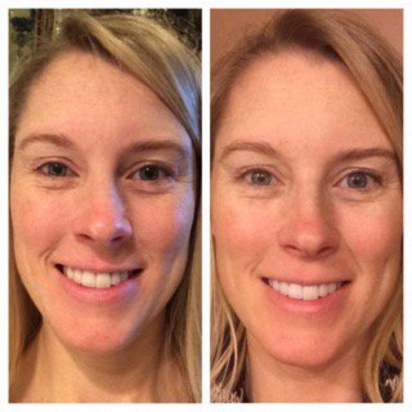 Drinking Water to Look Younger