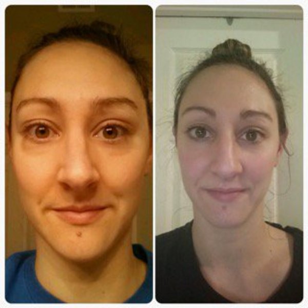 Drinking Water to Look Younger