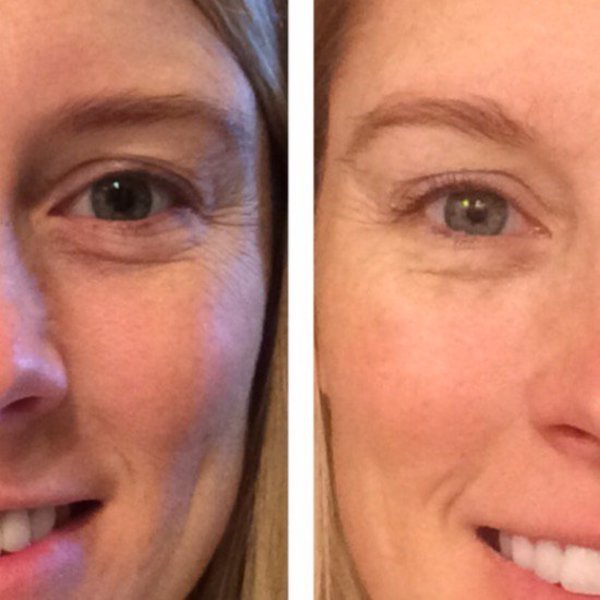 Drinking Water to Look Younger