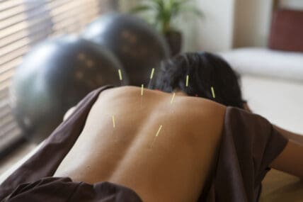 Should You Get Regular Acupuncture for Health Maintenance