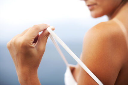 5 Natural Home Remedies for Sunburn Relief