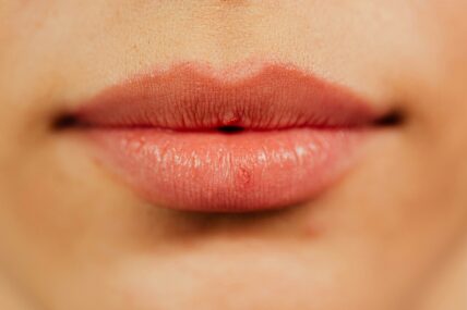 Best Natural Lip Sunscreens for Summer 2016